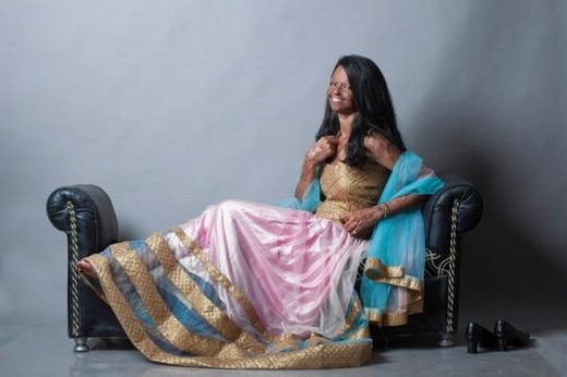 Photoshoot Acid Attack survivor