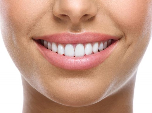 White Teeth