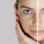 Treating Open Pores Naturally At Home treat open pores naturally