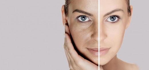 treat open pores naturally