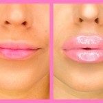 Get fuller lips naturally