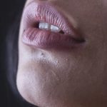 Get beautiful Lips This Winter And Say Bye Bye To The Chapped Ones With These Tricks Tips for chapped lips in winters