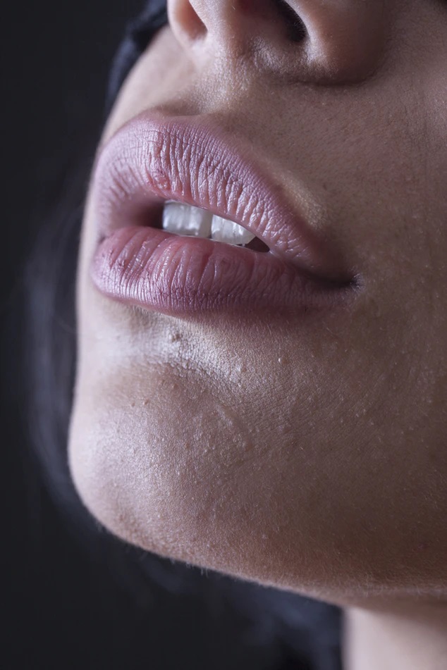 Tips for chapped lips in winters